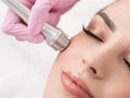 Microdermabrasion